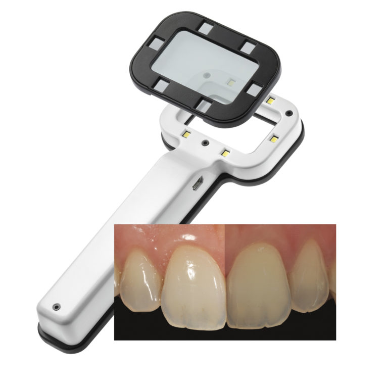اسمایل لایت- ست کامل اسمایل لاین - Smile Line